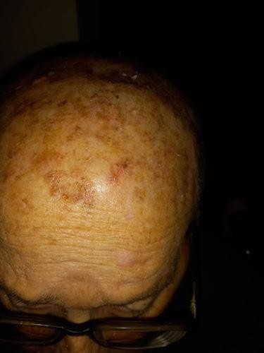 Bild von Dermatologie Bad Kreuznach - Dr. med. Georg Mauer